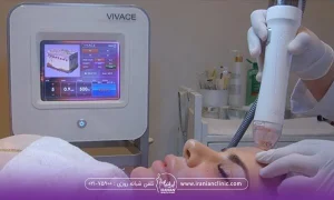 خانمی که خوابیده و دست اپراتوری که در حال انجام ار اف روی صورت وی است - بهترین مرکز آر اف در تهران