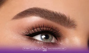 چشم و ابروی فردی که به یک سمت نگاه می کند - جدیدترین مدل های کاشت ابرو