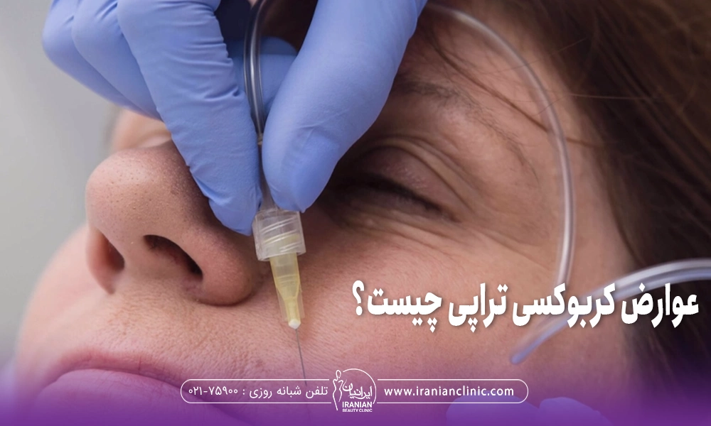 عوارض کربوکسی تراپی چیست؟