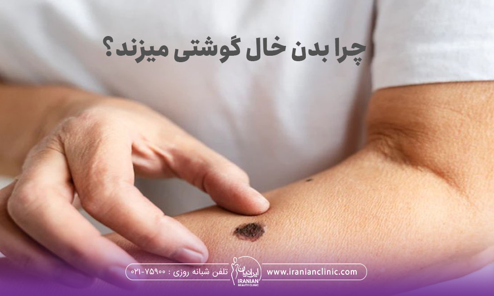 فردی که در با دو انگوشت دست دیگرش دور خالش را گرفته است
