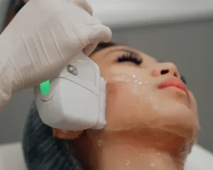 هایفوتراپی 500 شات حرفه ای