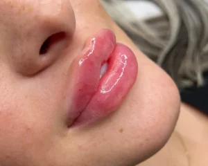 ژل لب روسی