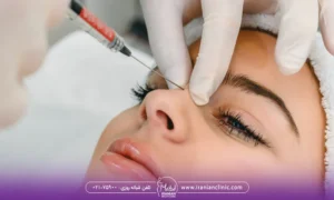دختری که دراز کشیده است و پزشک به بینی او فیلر تزریق می کند