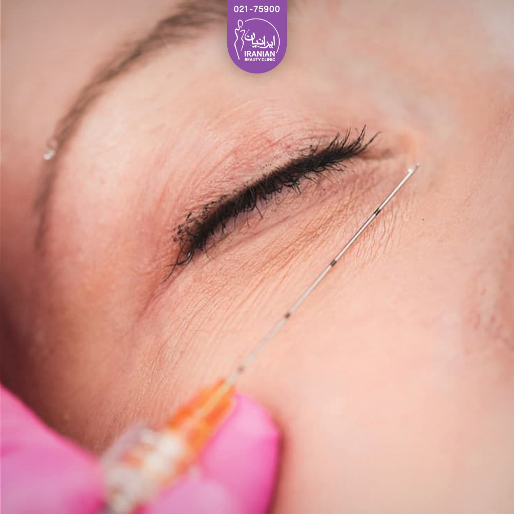 دست دکتری که سر سوزن کربوکسی تراپی را زیر چشم فرد گرفته است - کربوکسی تراپی دور چشم