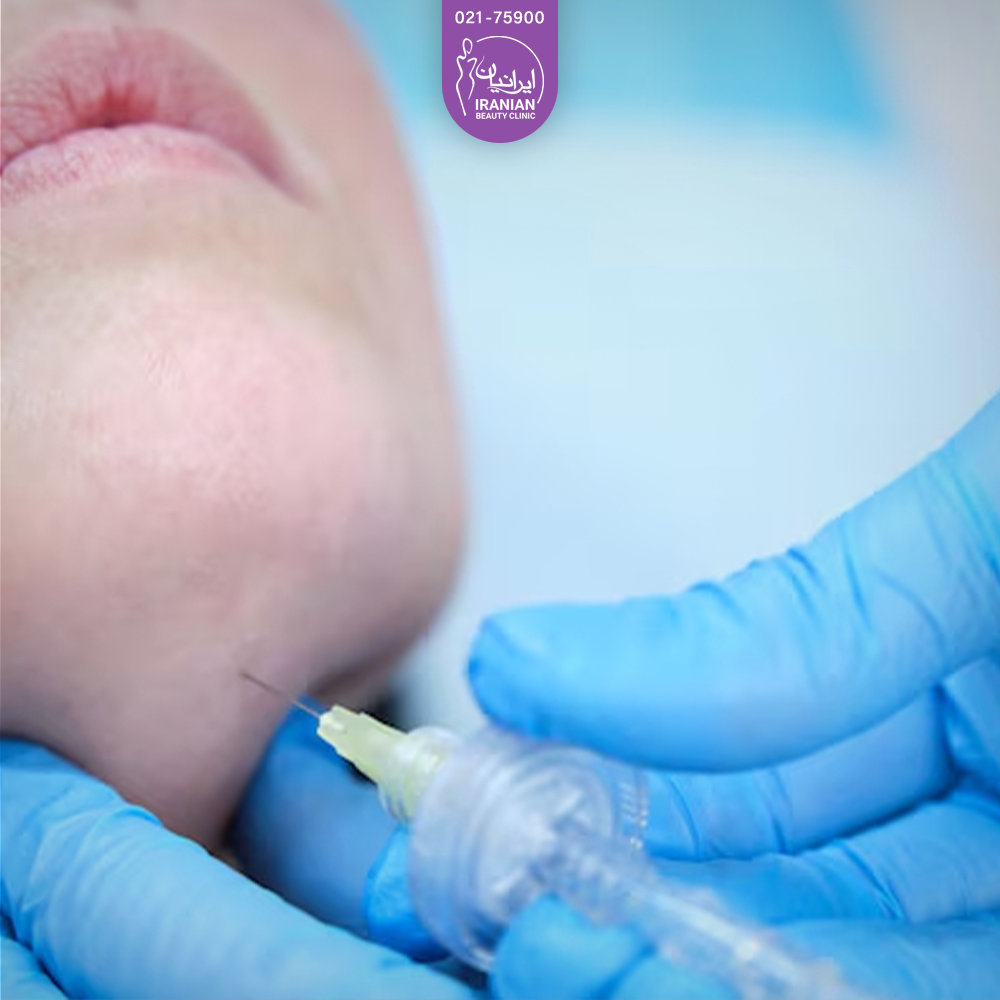 دست دکتری که در حال انجام کربوکسی تراپی زیر غبغب​ فرد است و دستکش آبی به ذست دارد - کربوکسی تراپی غبغب​