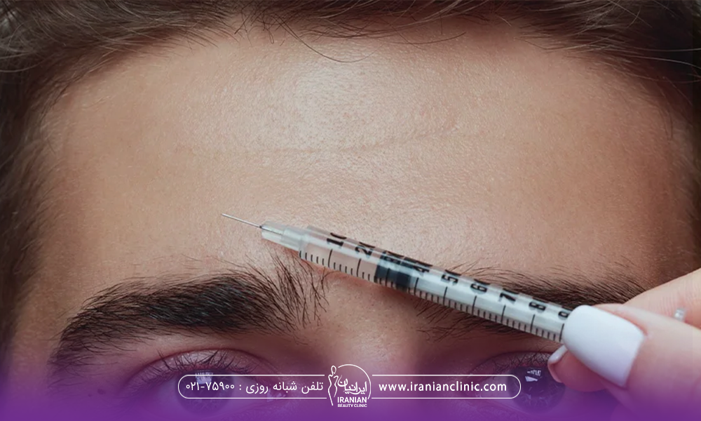 عکس پیشانی مرد که پزشک یک سرنگ حاوی بوتاکس را بالای ابروی او نگه داشته است