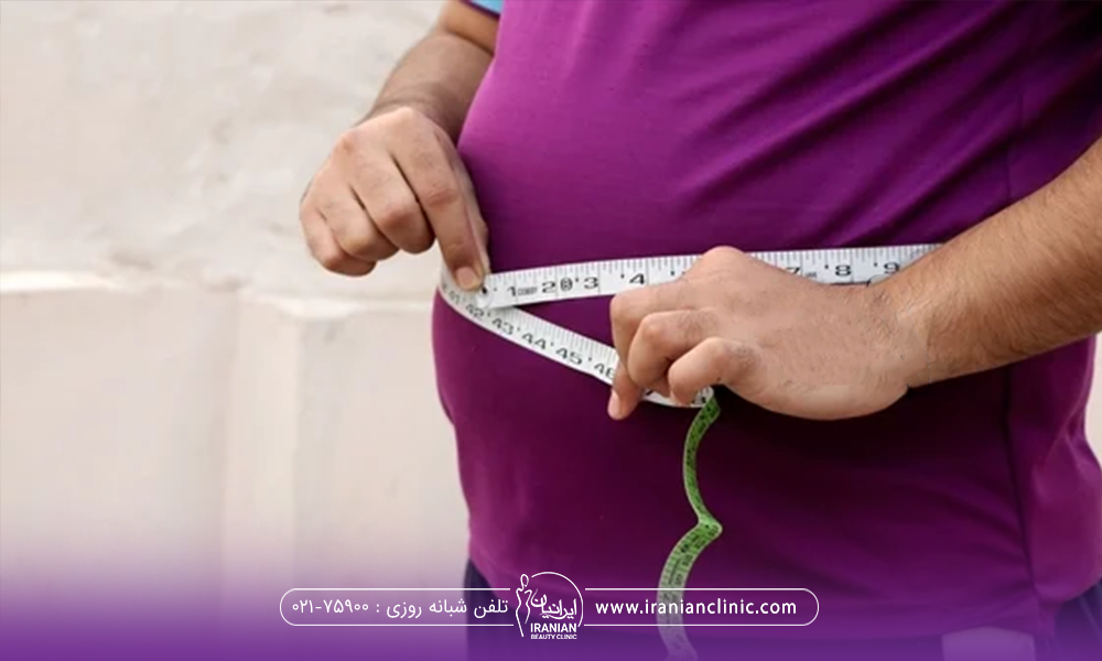 فردی که چاق است و متر را دور شکم خود نگه داشته است - رژیم غذایی بعد بوتاکس معده