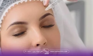 خانمی که کلاه مخصوص به سر دارد و دستان دکتری که در حال تزریق مزوژل به پیشانی خانم است - ماندگاری مزوژل جالپرو