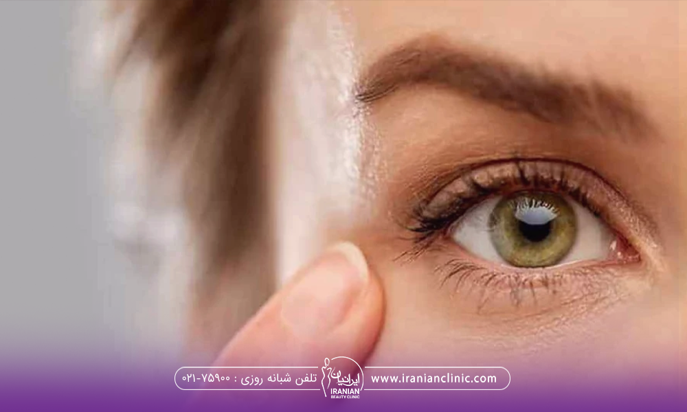 چشم راست دختری که انگشت خود را کنار چشمش نگه داشته است
