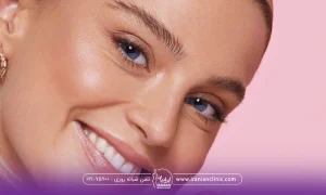 خانم خوشحالی که سرش را کج کرده و به رو به رو نگاه می کند - نوره برای چاقی صورت