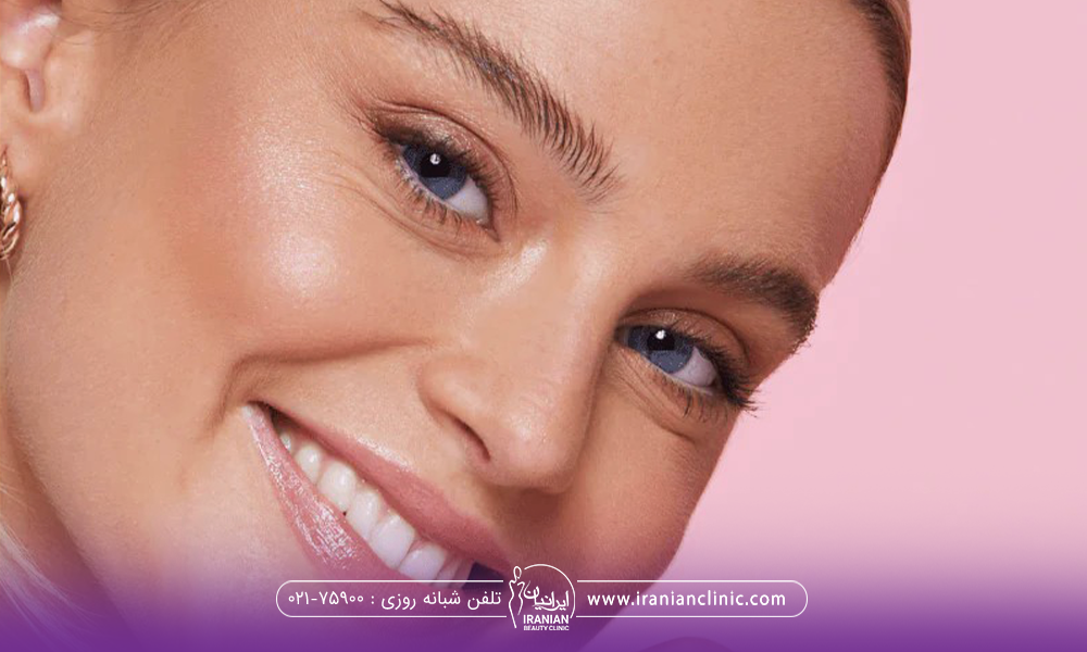 خانم خوشحالی که سرش را کج کرده و به رو به رو نگاه می کند - نوره برای چاقی صورت