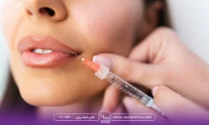 پزشکی که به گوشه لب بالای دختر ژل تزریق می کند - هزینه تزریق فیلر