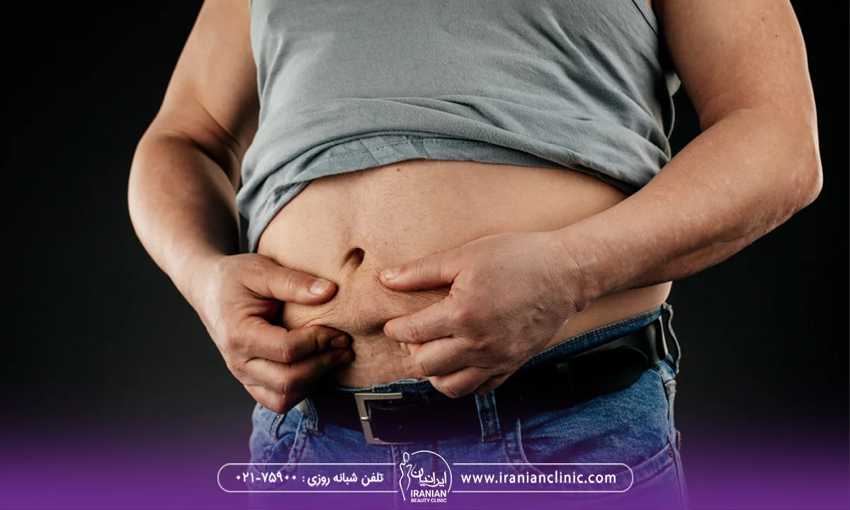 مردی که چربی شکم خود را با دستش نگه داشته است - هزینه لیپوماتیک