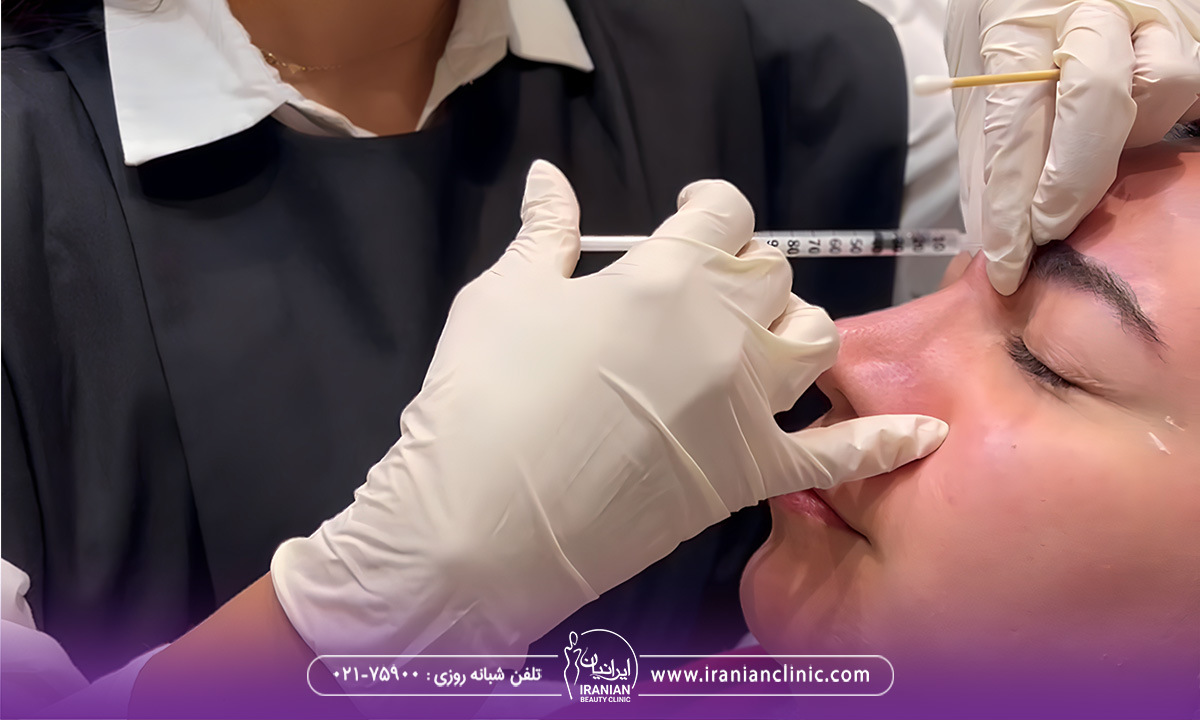 هزینه تزریق بوتاکس