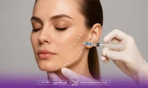 کانتورینگ دائمی یا موقت؟