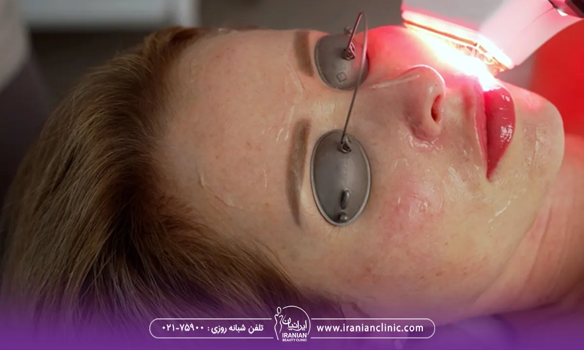 تجربه واقعی افراد از عوارض هایفوتراپی در کلینیک ایرانیان