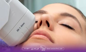 نظرات کسانی که هایفوتراپی انجام داده اند! نظرات و تجربیات واقعی