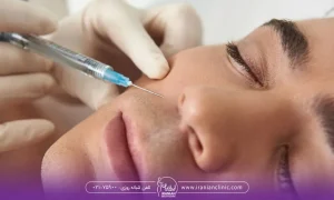 مرد که پزشک به خط لبخند او فیلر تزریق می کند