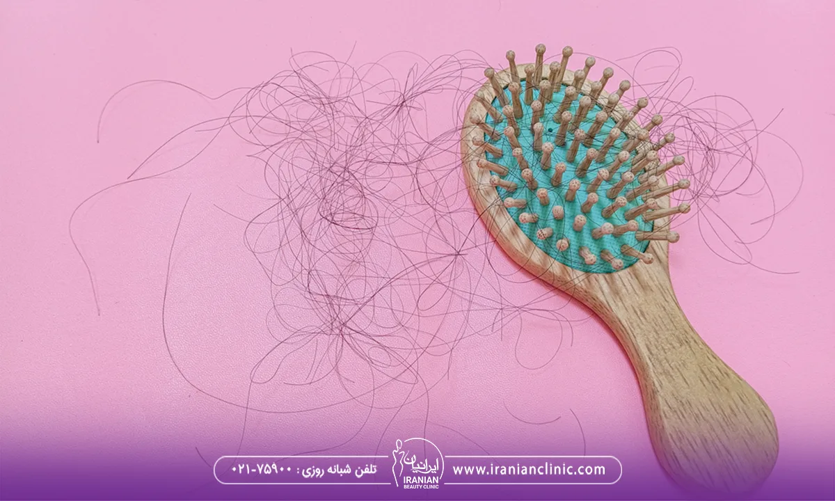 پیشگیری از تلوژن افلوویوم