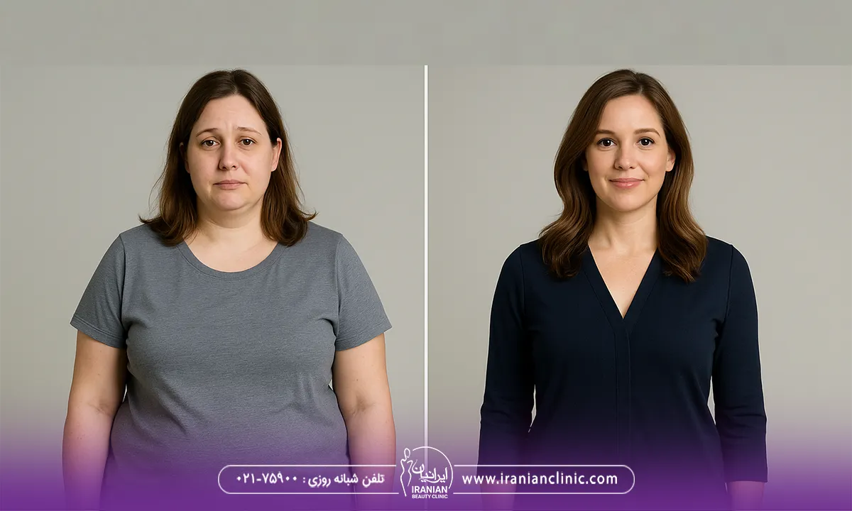 مامی میک‌ اوور