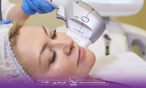 مزایای هایفوتراپی برای لک صورت نسبت به روش های دیگر