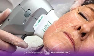 عکس بدون فیلتر هایفوتراپی صورت، هزینه هایفوتراپی برای صورت