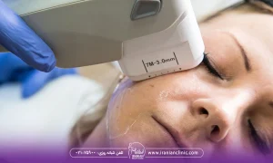 خانمی درحال برطرف کردن لک صورت و جوانسازی پوست صورت با هایفوتراپی، هایفوتراپی برای لک صورت چقدر تاثیر دارد؟