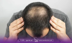 تأثیر هایفوتراپی مو در افزایش ضخامت موها