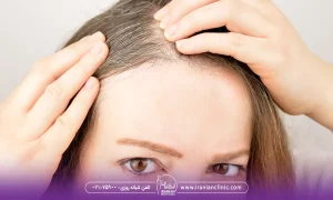 مقایسه هایفوتراپی مو با دیگر روش ها