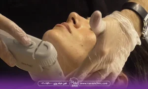 10 گروه پرخطر که نباید هایفو انجام دهند