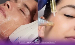 برای نواحی مختلف صورت و بدن هایفوتراپی بهتره یا میکرونیدلینگ