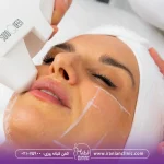 خانمی که هایفوتراپی انجام می دهد برای ومین بار بخاطر حفط دوام هایفو