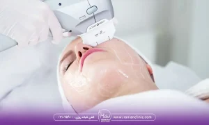 ماندگاری هایفوتراپی نواحی مختلف صورت و بدن