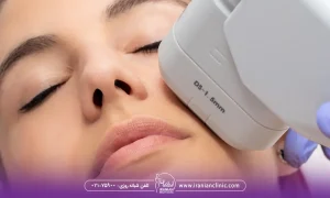 نکات قبل و بعد از مراجعه به مرکز هایفوتراپی در شرق تهران