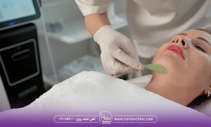 قبل از انجام هایفو غبغب ژلی استفاده می شود که عولارض هایفوتراپی غبغب را کاهش دهد