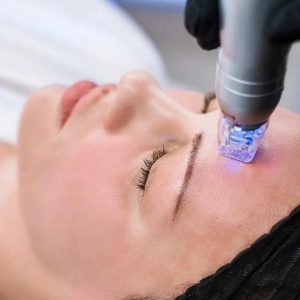 ۳ جلسه آر اف اسکارلت با ۱۲ میلیون و ۴۰۰ تخفیف ویژه