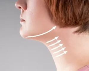 لاغری و لیفت غبغب