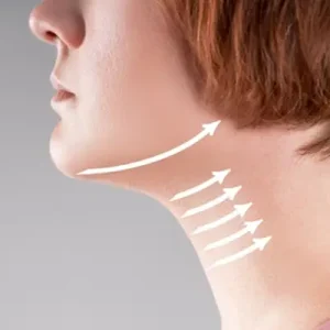 لاغری و لیفت غبغب