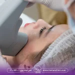 چه کسانی نباید هایفو انجام دهند!