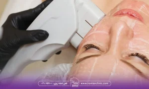 خانمی که هایفو لک صورت انجام می دهد، مراقبت های بعد از هایفوتراپی برای لک صورت