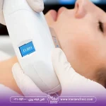 مراقبت های بعد از هایفوتراپی و ۱۶ نکته مهم بعد از هایفو صورت