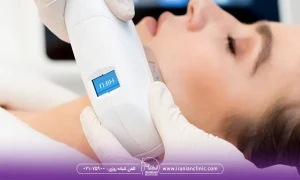 مراقبت های بعد از هایفوتراپی و ۱۶ نکته مهم بعد از هایفو صورت