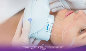 تفاوت هایفو هفت بعدی و هایفو چهار بعدی چیست