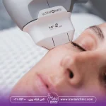 هزینه هایفوتراپی دور چشم، خانمی که هایفوتراپی دور چشم انجام می دهد