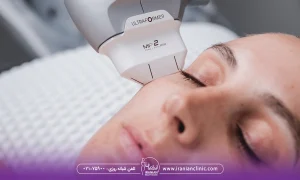 هزینه هایفوتراپی دور چشم، خانمی که هایفوتراپی دور چشم انجام می دهد