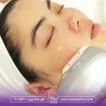 فواید هایفوتراپی برای صورت