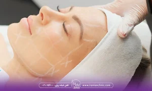 چرا مراقبت های بعد از هایفوتراپی صورت مهم است؟