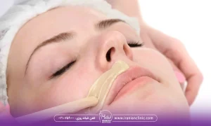 انجام ندادن وکس یا اپیلاسیون بعد از هایفوتراپی صورت