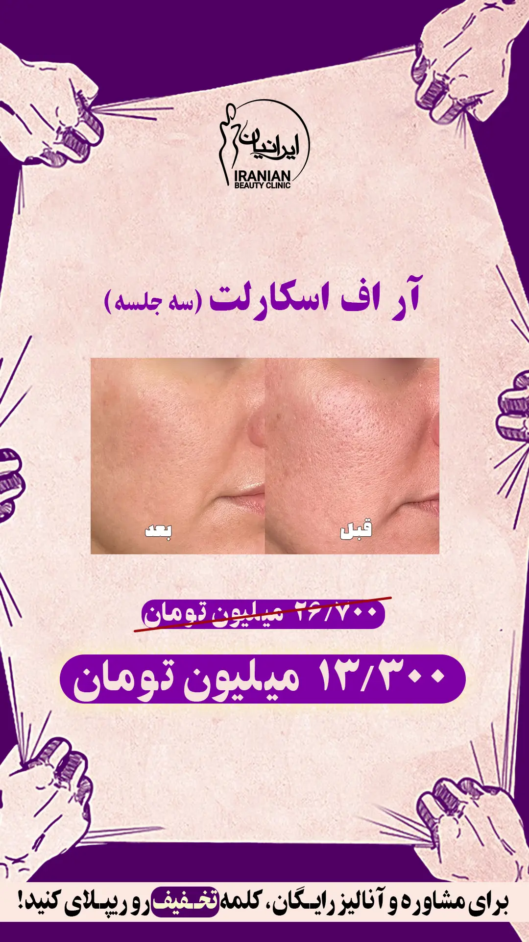 آر اف اسکارلت (1)