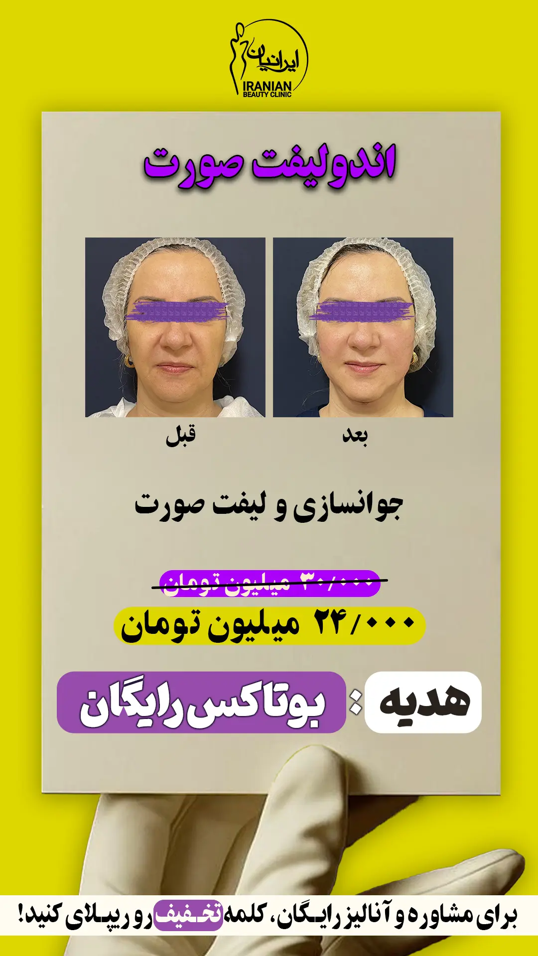 اندولیفت (1)